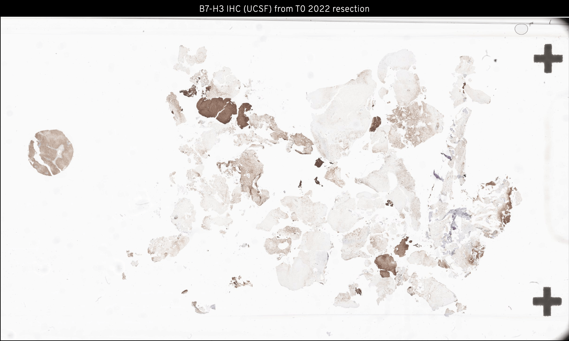 B7-H3 IHC Slide preview