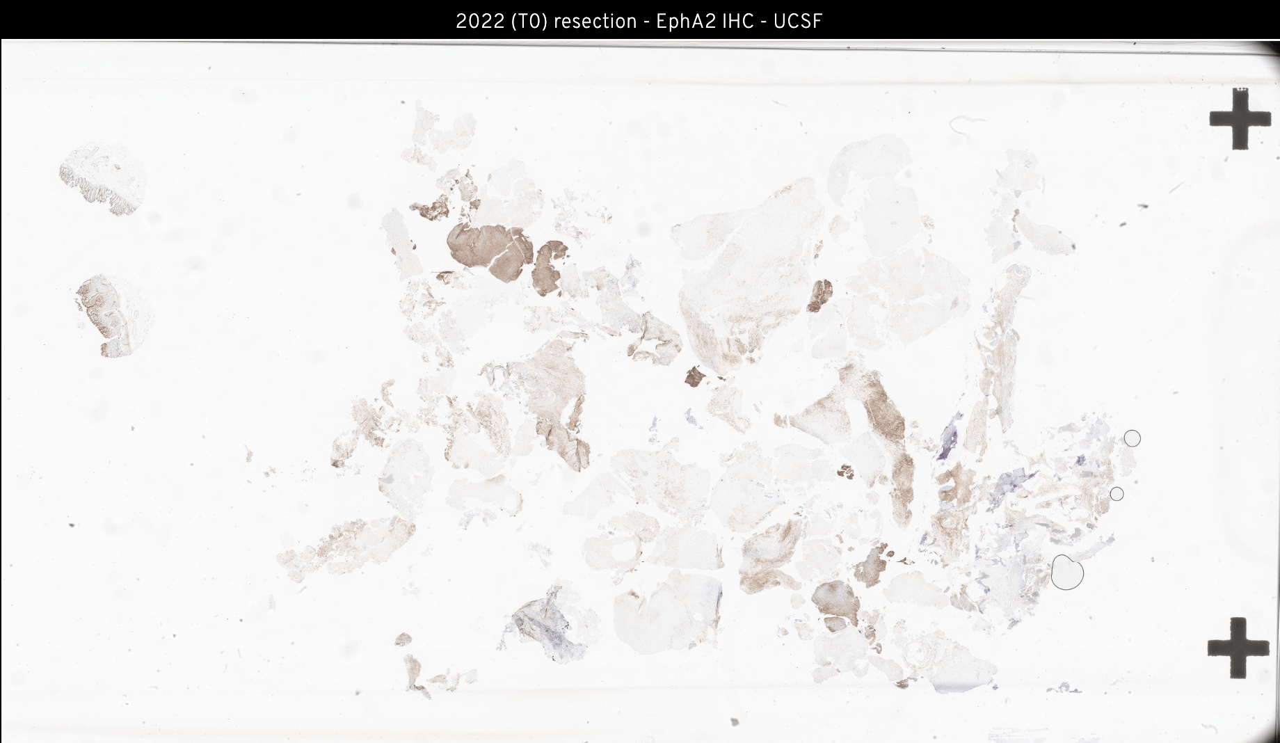 EphA2 IHC Slide preview