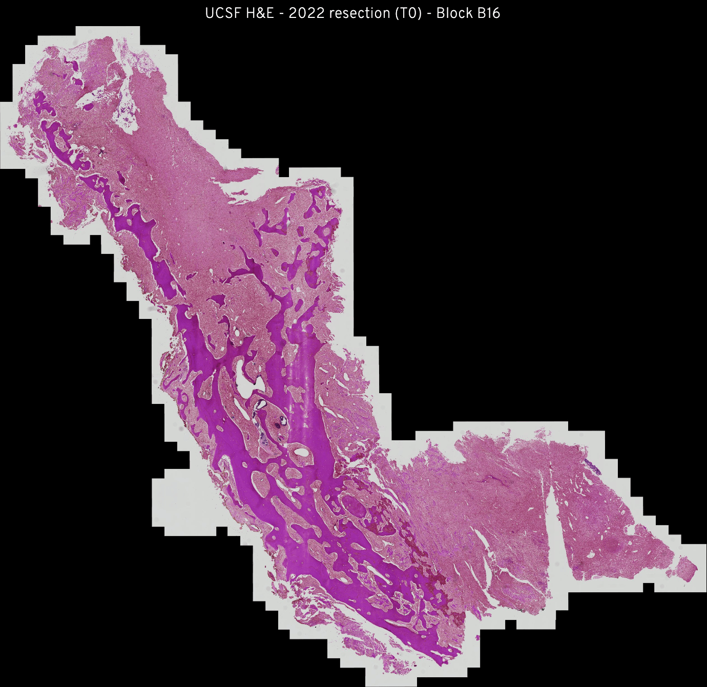 H&E UCSF B16 preview