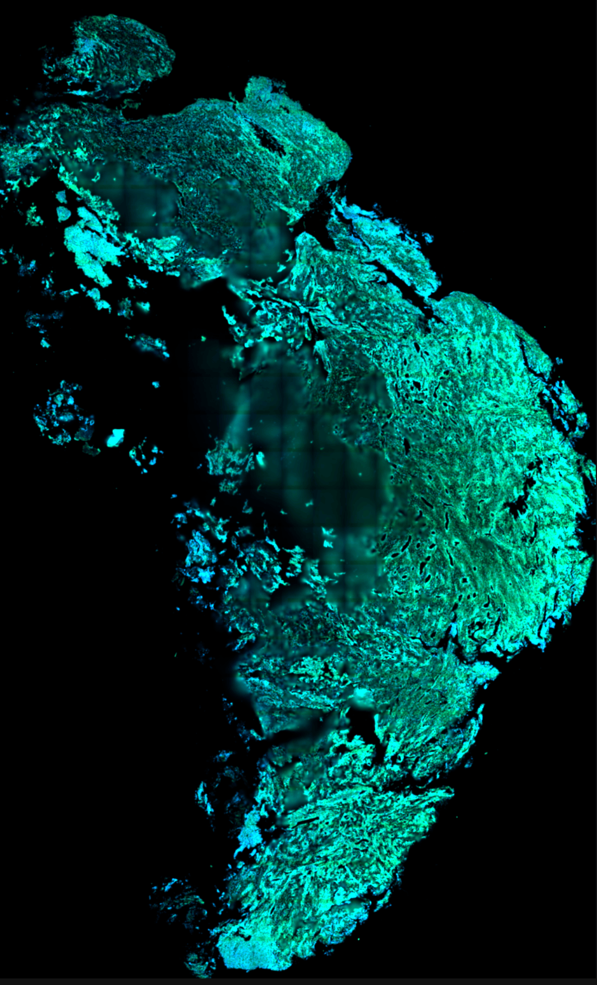 2022 Xenium - Block C3 preview